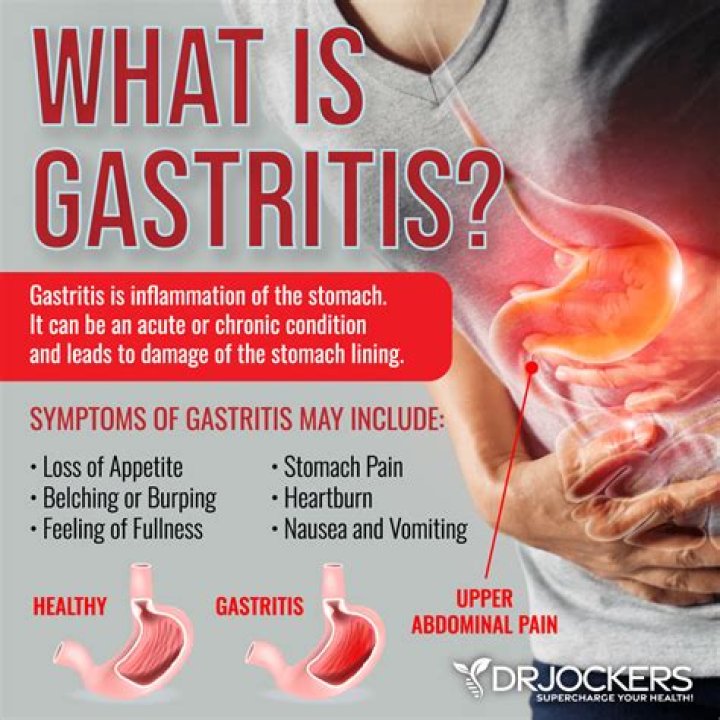 Can gastritis cause severe upper abdominal pain?