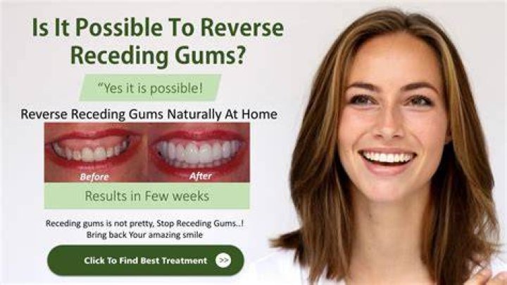 Can mouthwash reverse receding gums?