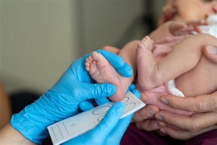 Do they test for PKU at birth?