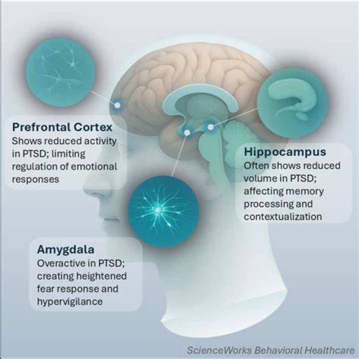 How does PTSD affect the ventromedial prefrontal cortex?