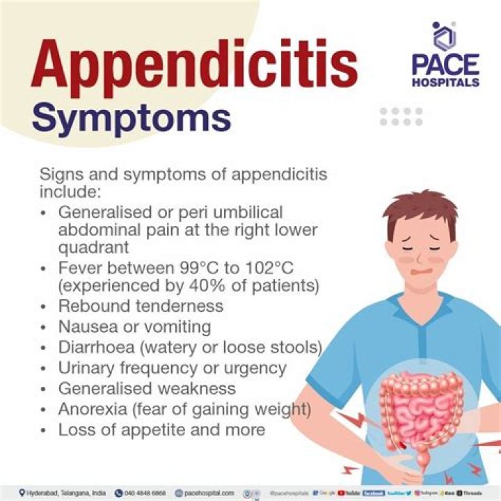 What are the 4 types of appendicitis?