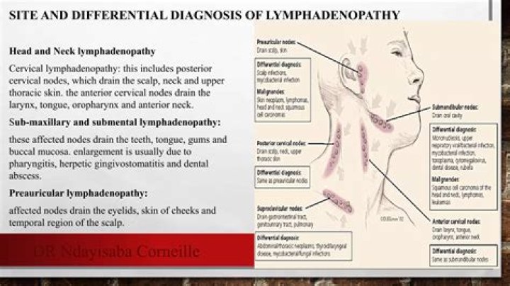 What is generalized lymphadenopathy indicative of?