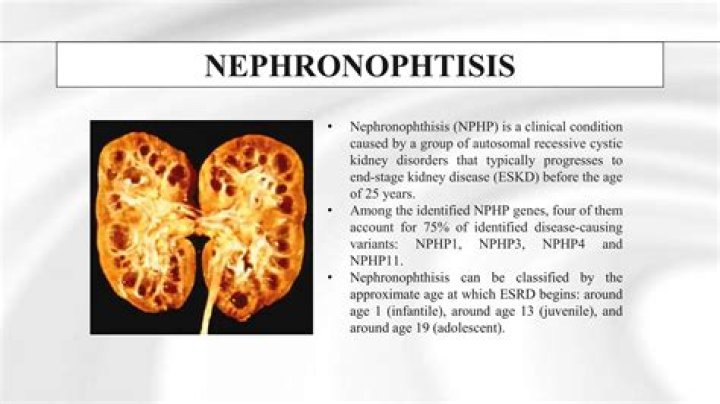 What is Nephronophthisis?