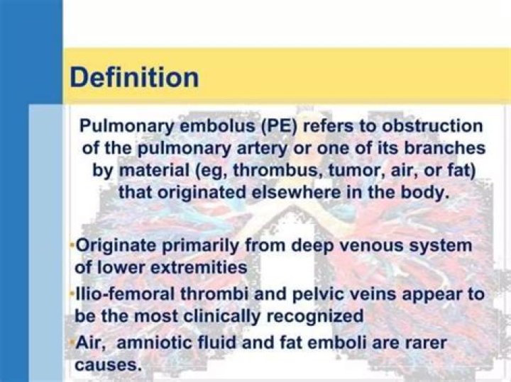 What is the meaning of pulmonary embolism PPT?