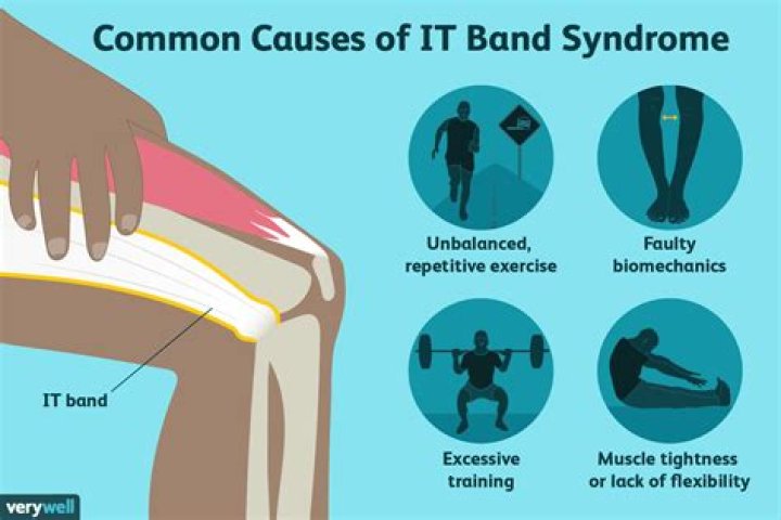 Why does my IT band get tight when I run?